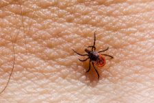 Punkkipurema ja borrelioosi kokemuksia Image by Erik Karits from Pixabay
